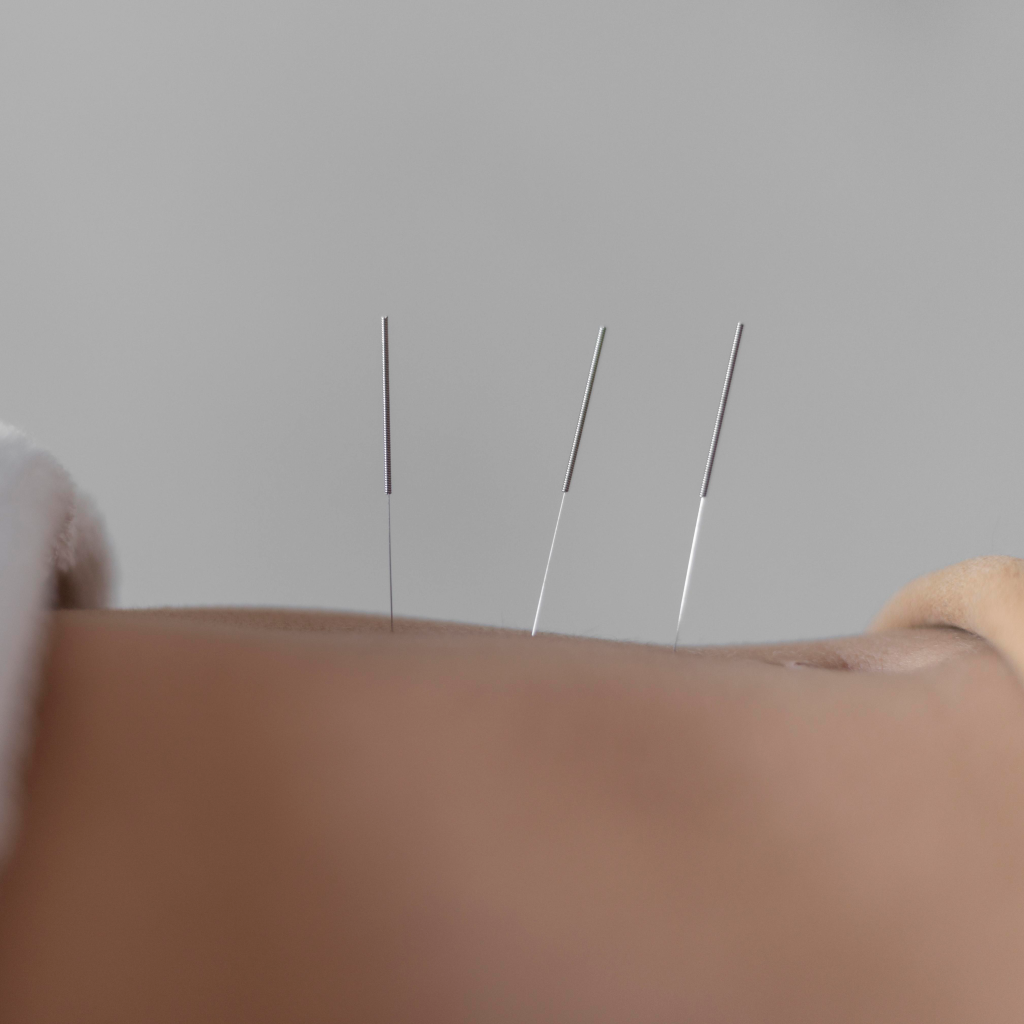 Formación en Acupuntura, Seminario