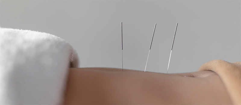 Curso de acupuntura integrativa